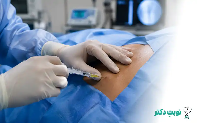 مراحل انجام تزریق اپیدورال