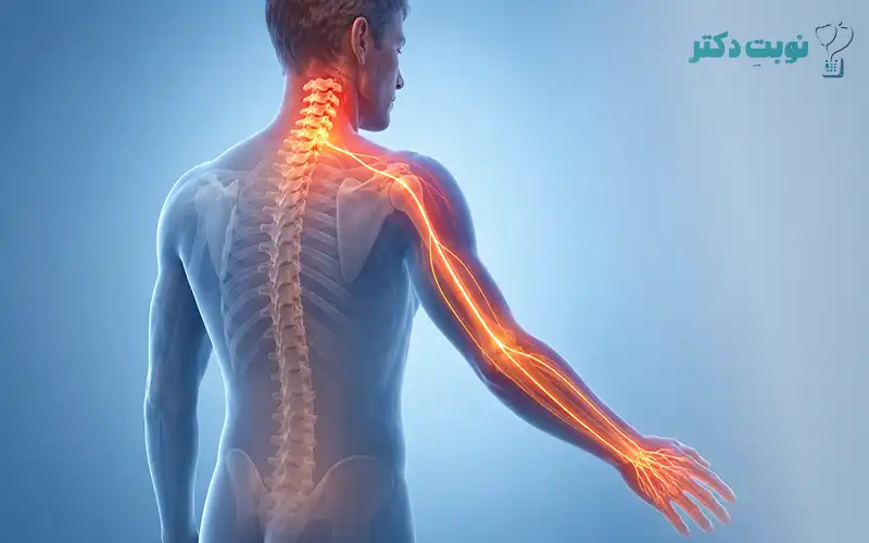 انتشار درد گردن به شانه و دست