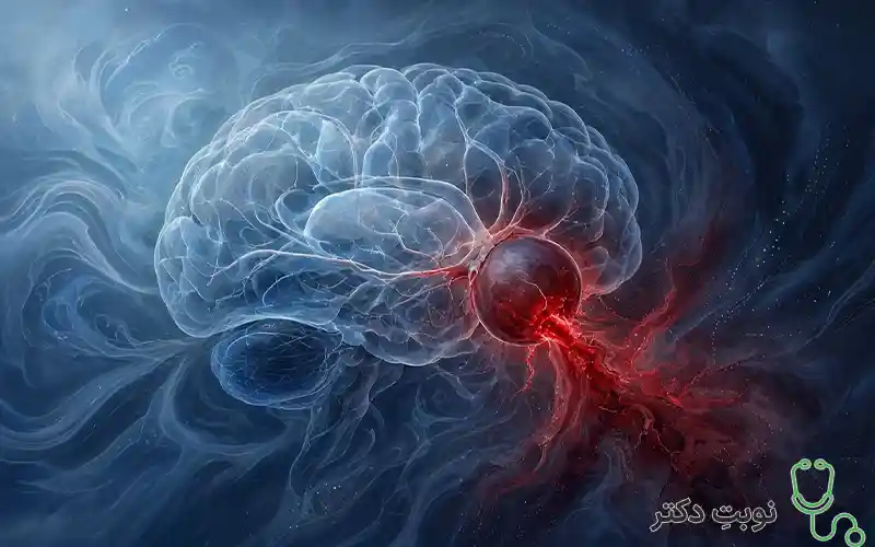 عوارض آنوریسم مغزی