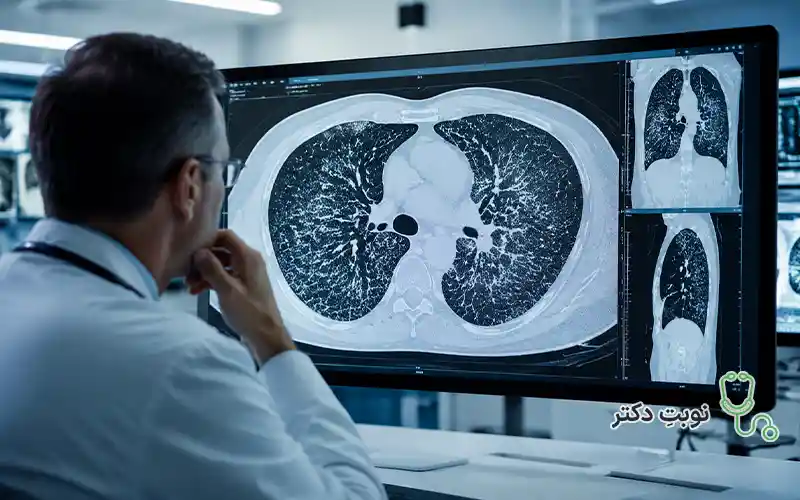 روش های تشخیص پنوموکونیوز چیست